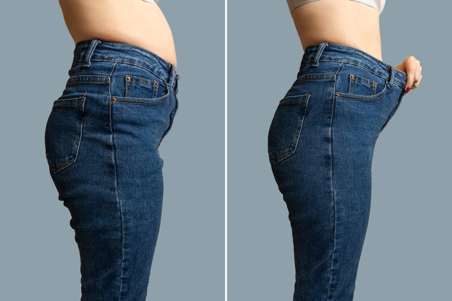 Before and after photo aesthetics care