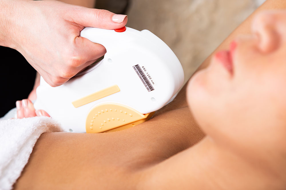 hair removal by intense pulsed light