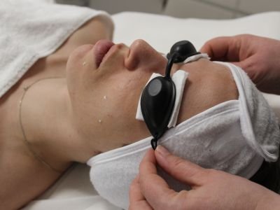 IPL skin rejuvenation protocol eye protection