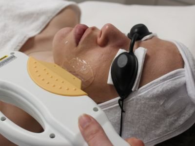 IPL skin rejuvenation protocol activation of the pulsed light device