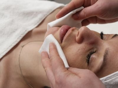 IPL skin rejuvenation protocol clean the area