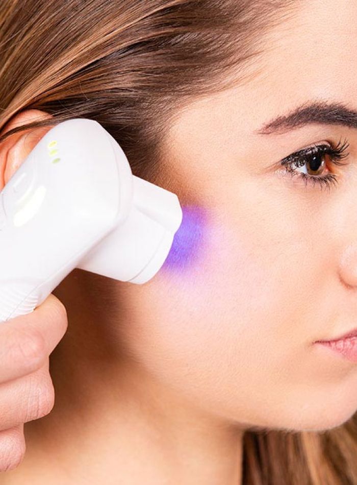 Diode Laser Hair Removal Device LASERA