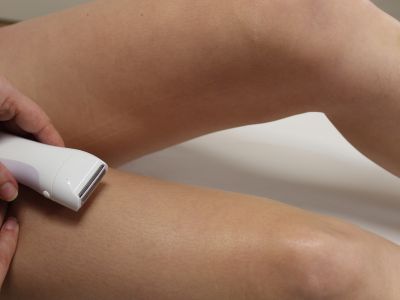 IPL hair removal protocol shaving of treated area